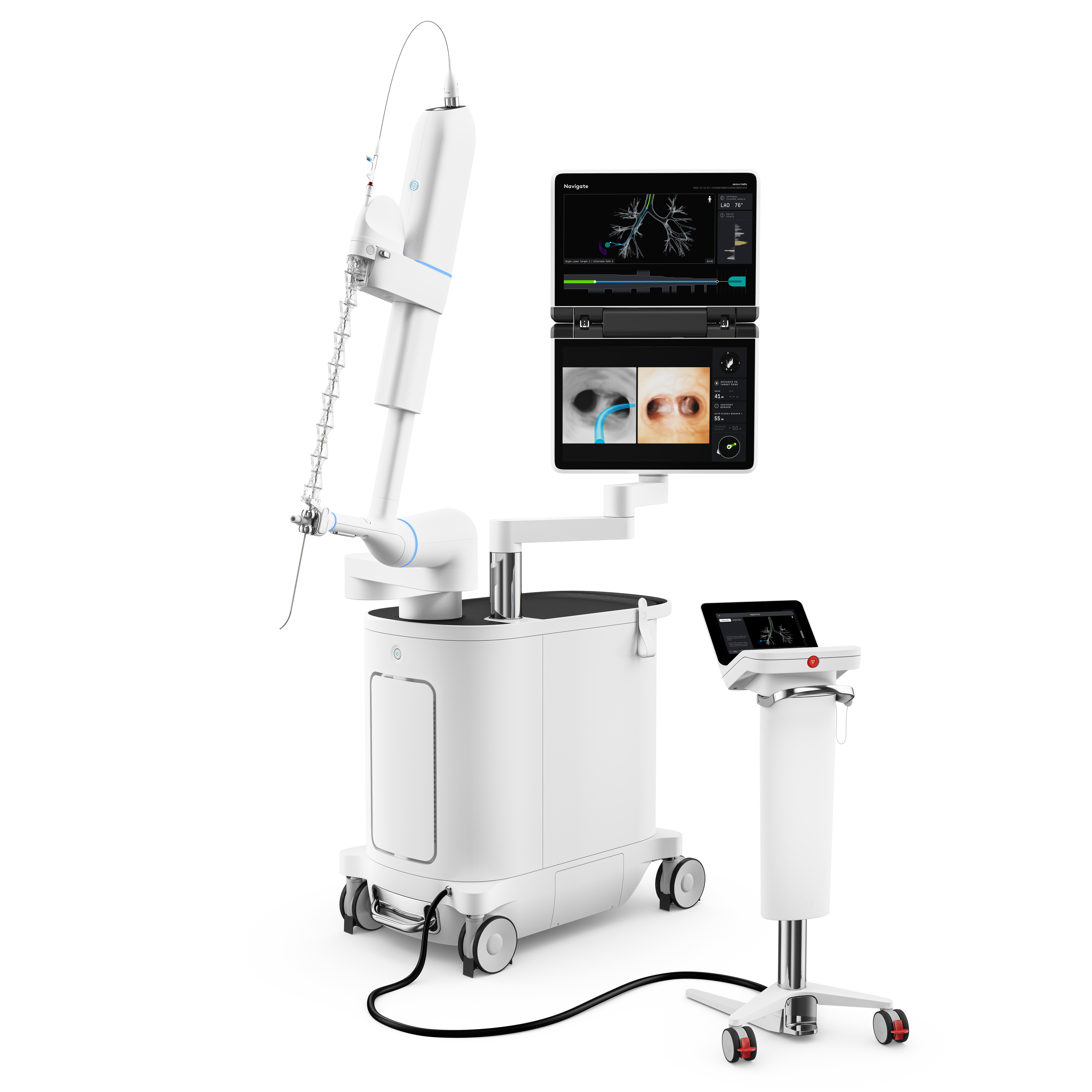 Ion, a robotic-assisted system for minimally invasive biopsies, is an advanced way to navigate through the airways and bronchial tree for precise biopsy samples.